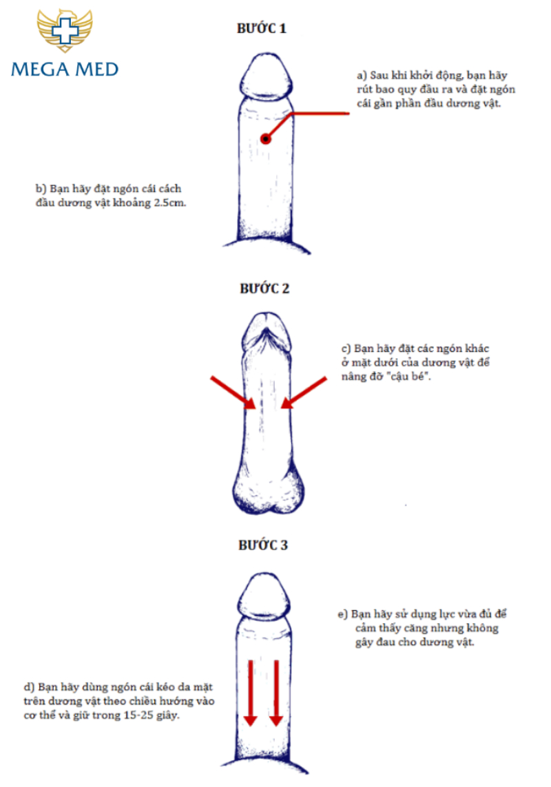 Hướng dẫn bài tập tăng kích thước dương vật tuổi dậy thì Backward Puller